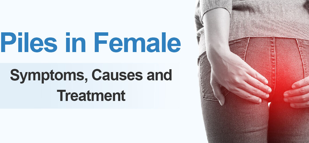 Piles in Women: Symptoms, Causes, and Best Treatment Options